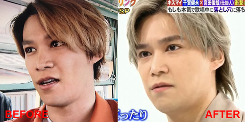 千賀健永の顔の変化を比較画像で検証してみた！